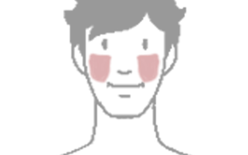 両ほほの脱毛範囲