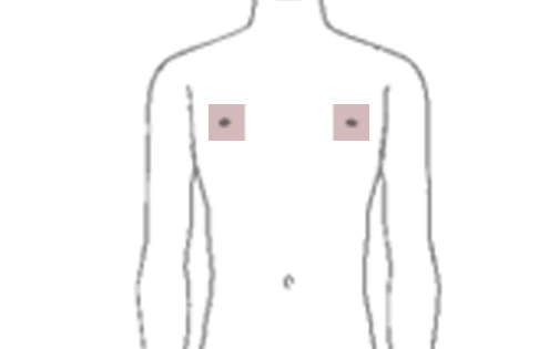 乳首周りの脱毛範囲